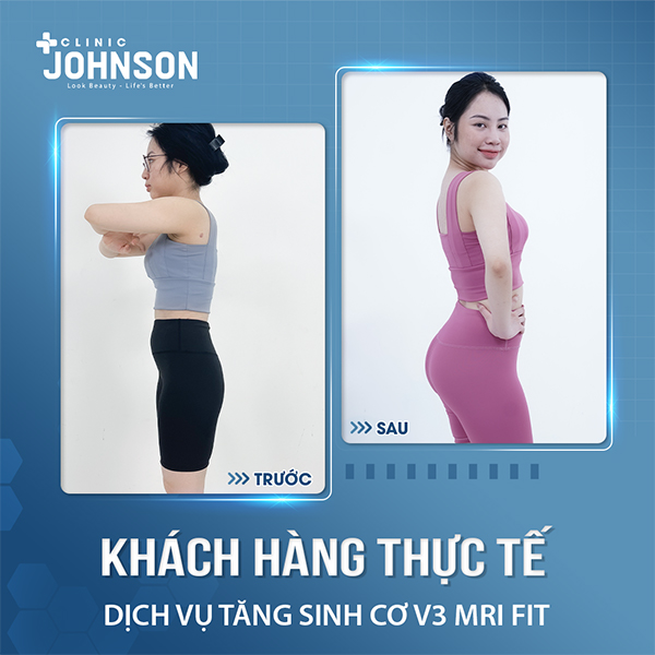 Khách hàng thực tế tại Johnson Clinic