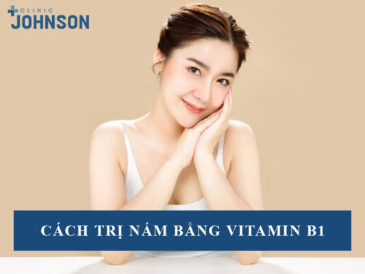 Cách trị nám bằng vitamin b1