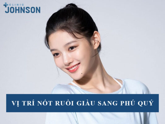Nốt ruồi giàu sang phú quý
