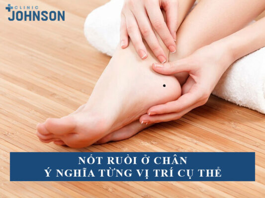 nốt ruồi ở chân