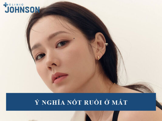 Nốt ruồi ở mắt