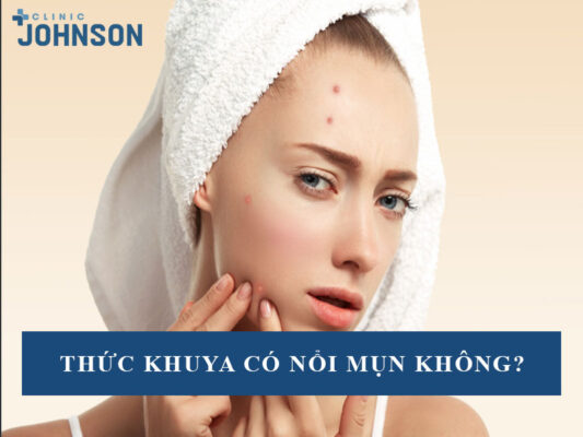 Thức khuya có nổi mụn không