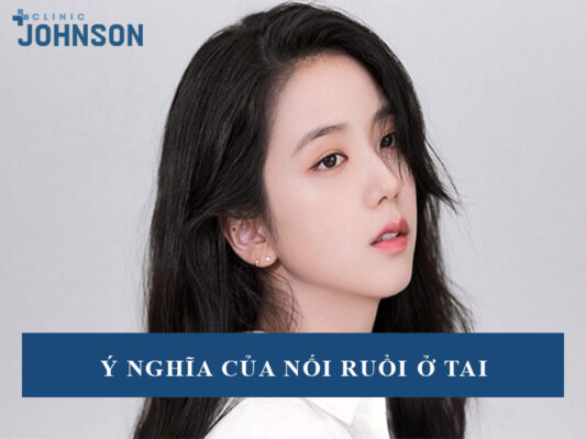 Nốt ruồi ở tai