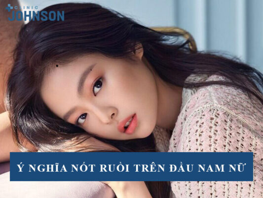 Nốt ruồi trên đầu
