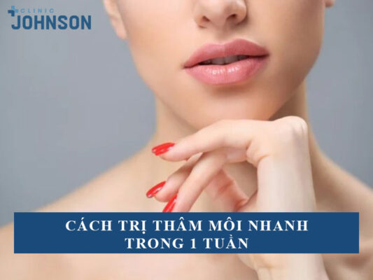 Cách trị thâm môi nhanh trong 1 tuần