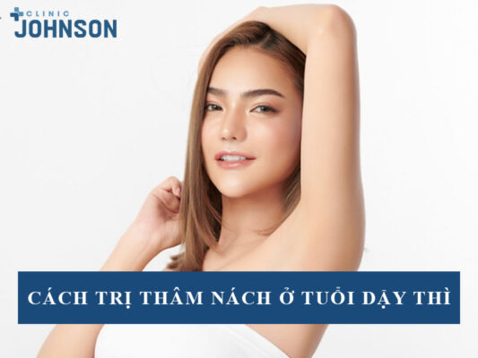 Cách trị thâm nách ở tuổi dậy thì
