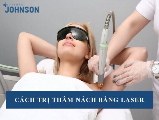 Trị thâm nách bằng laser