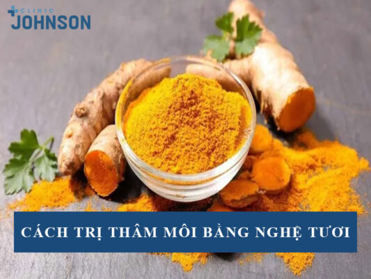 Cách trị thâm môi bằng nghệ tươi