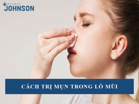 Mụn trong lỗ mũi