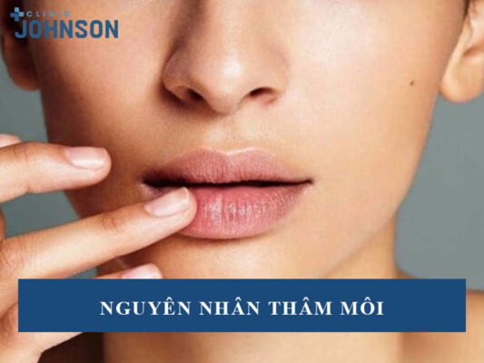 Nguyên nhân thâm môi
