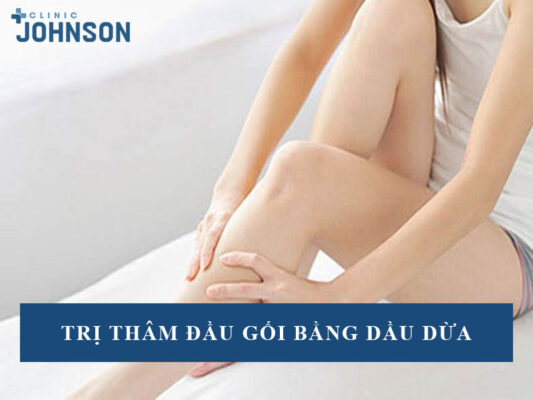Trị thâm đầu gối bằng dầu dừa