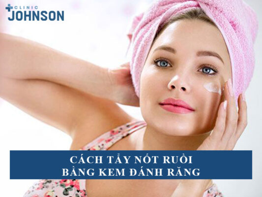 Cách tẩy nốt ruồi bằng kem đánh răng