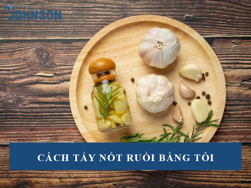 Cách tẩy nốt ruồi bằng tỏi
