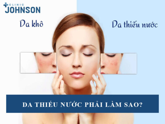 Da thiếu nước