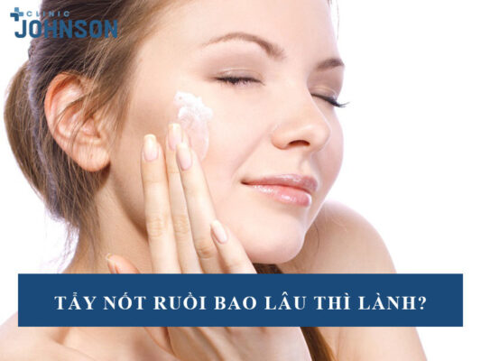Tẩy nốt ruồi bao lâu thì lành