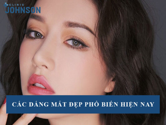 các dáng mắt