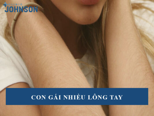 Con gái nhiều lông tay