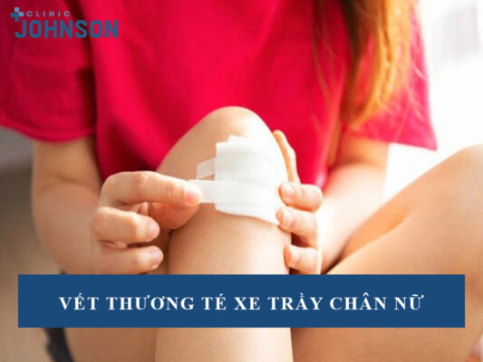 Vết thương té xe trầy chân nữ