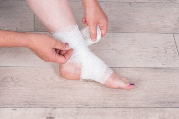 Vết thương té xe trầy chân nữ giới