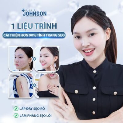 dieu-tri-seo-max-scar-plus-johnson-clinic