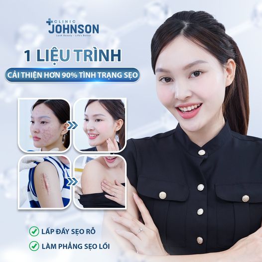 điều trị sẹo max scar plus johnson clinic