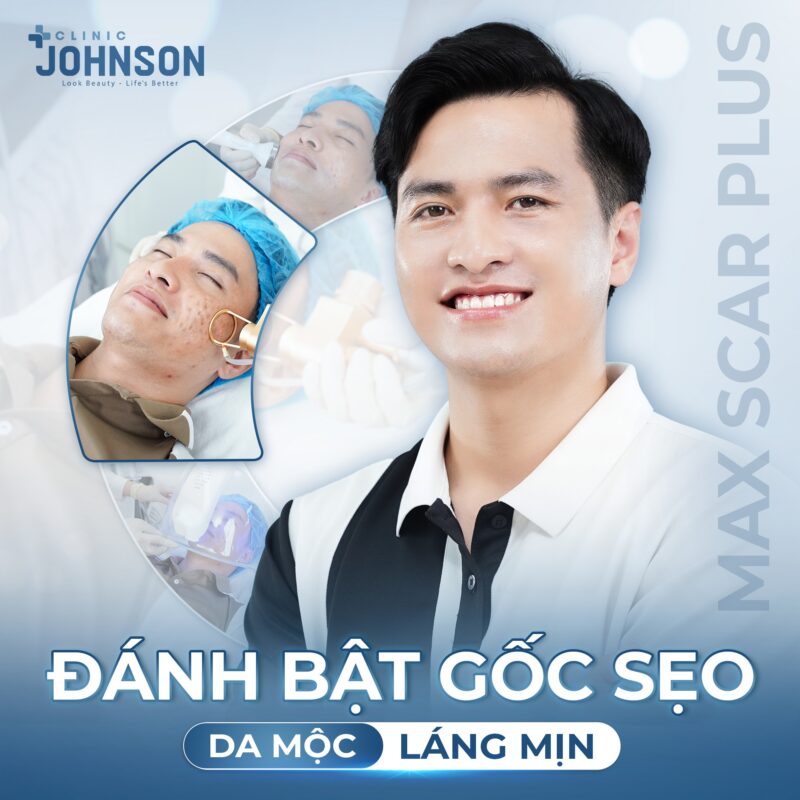 dieu-tri-seo-max-scar-plus-tai-johnson-clinic