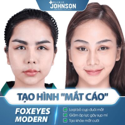 Fox Eyes Modern tạo hình mắt cáo