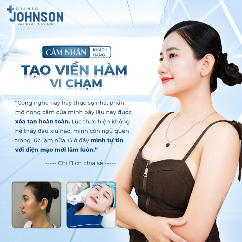 tạo viền hàm vi chạm Johnson Clinic