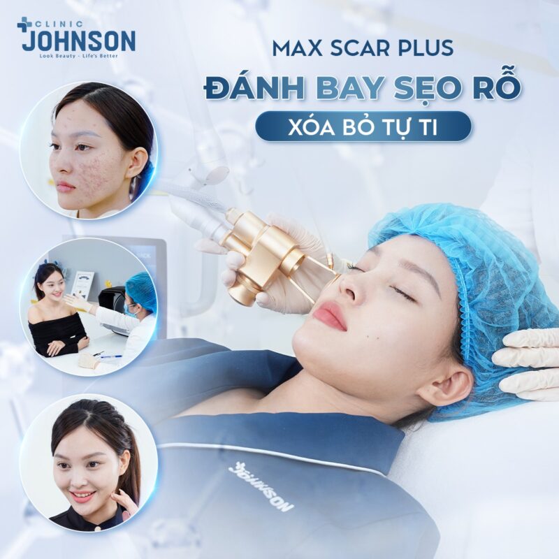 tri-seo-max-scar-plus-tai-johnson-clinic