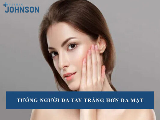 tướng người da tay trắng hơn da mặt