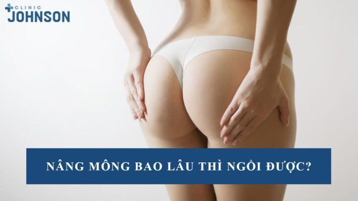 nâng mông bao lâu thì ngồi được